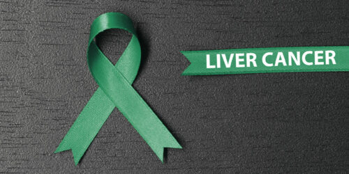 Liver Cancer – Causes, Symptoms, and Therapies