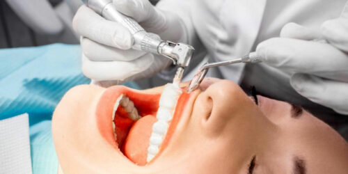 4 Medicare dental plans that cover your dental care