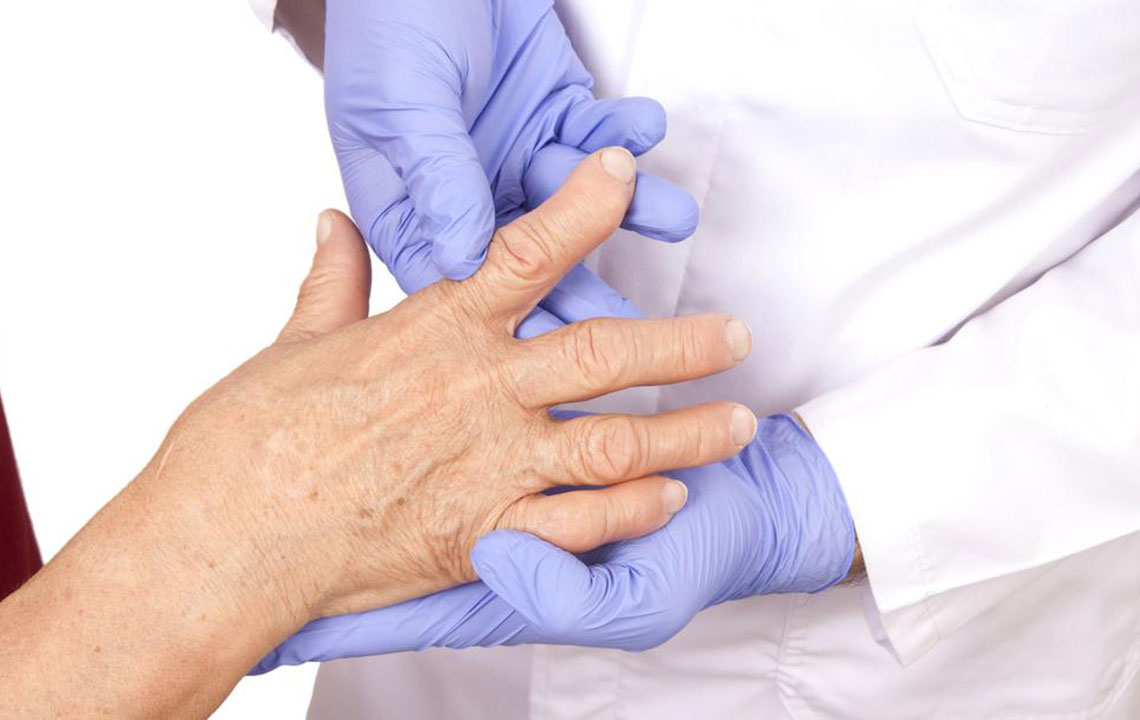 4 best remedies for rheumatoid arthritisÂ