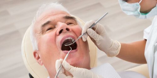 4 ways to get affordable senior dental implants