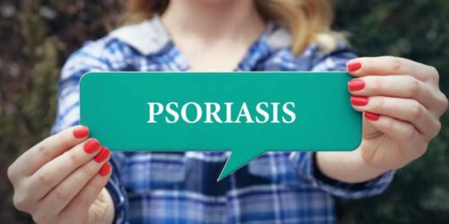 5 Ways to Treat Plaque Psoriasis at Home