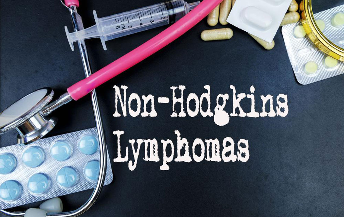 6 common risk factors for Non-Hodgkin lymphoma