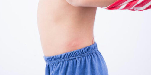 10 common types of skin rashes you should be aware ofÂ