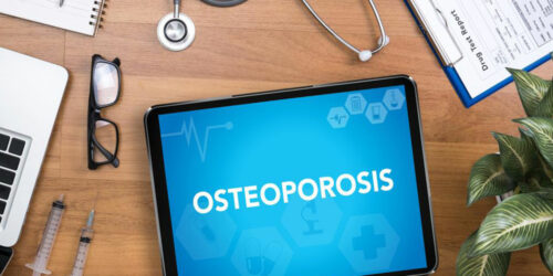 A brief overview of osteoporosis