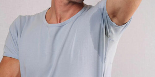 Advanced management of excessive sweating