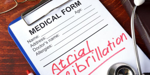 An overview of Atrial Fibrillation