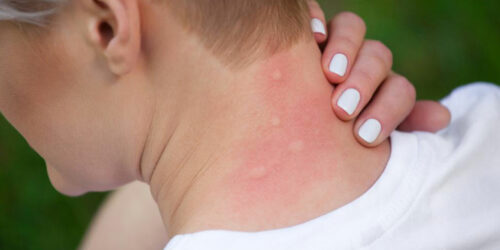 Causes and diagnosis of itchy skin