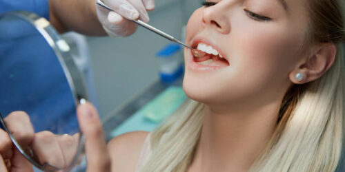 Dental insurance &#8211; Is it worth a bite?