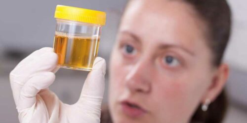 Determining Your Health with a Urine Color Chart