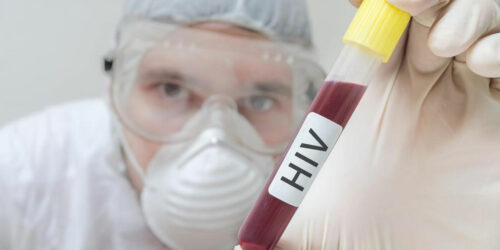 Diagnosis of HIV AIDS – A proper treatment starts with proper diagnosis