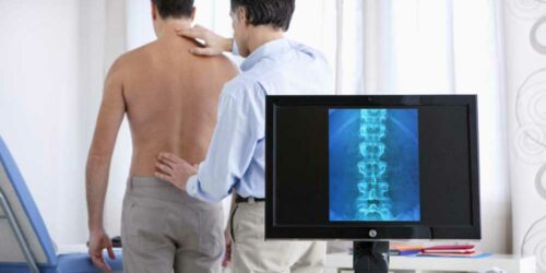 Early Warning Signs of a Spinal Compression Fracture