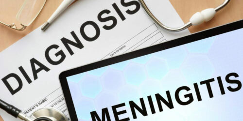 Everything you need to know about meningitis