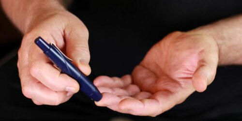 Here are a few common causes and symptoms of type 2 diabetesÂ