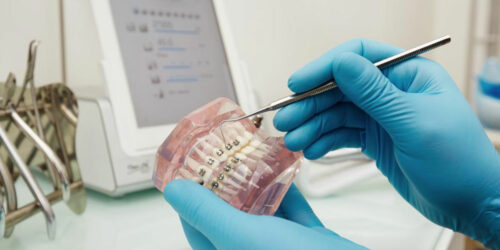 How to find affordable dentures?