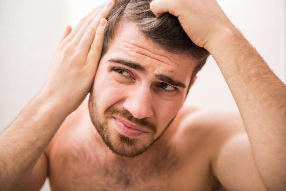 Natural remedies for baldness that you should try