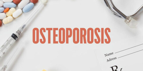 Ten steps to avoid or reverse osteoporosis