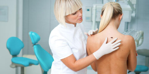 Things you should know about stage four melanoma