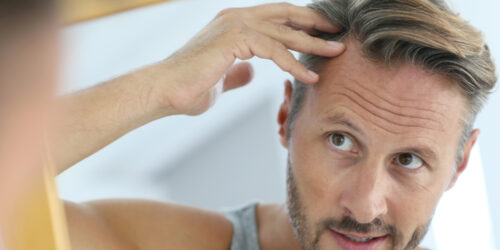 Treatment Options for Hair Loss