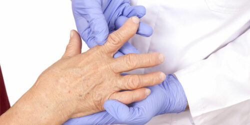 Understanding the various types of arthritis