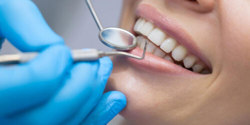 What to expect with dental implants