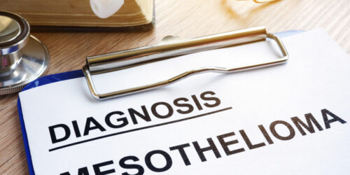 5 Treatment Options for Mesothelioma