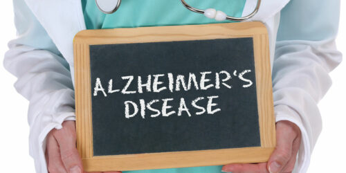 5 things to know about Alzheimer’s disease