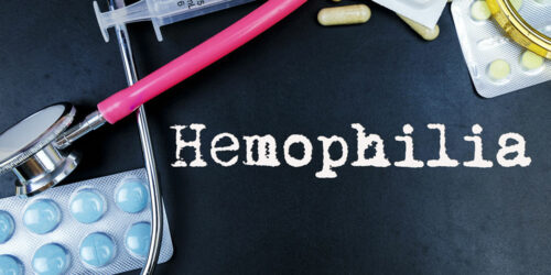 6 common treatment options for hemophilia