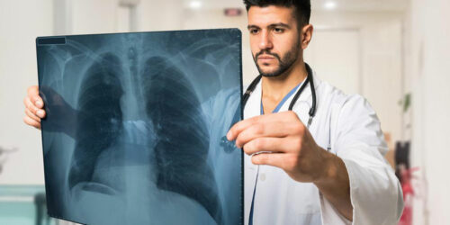 9 Pneumonia Symptoms You Must Be Aware Of