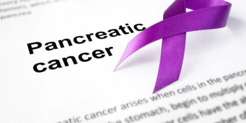 9 Pancreatic Cancer Symptoms You Wouldn’t Believe Exist