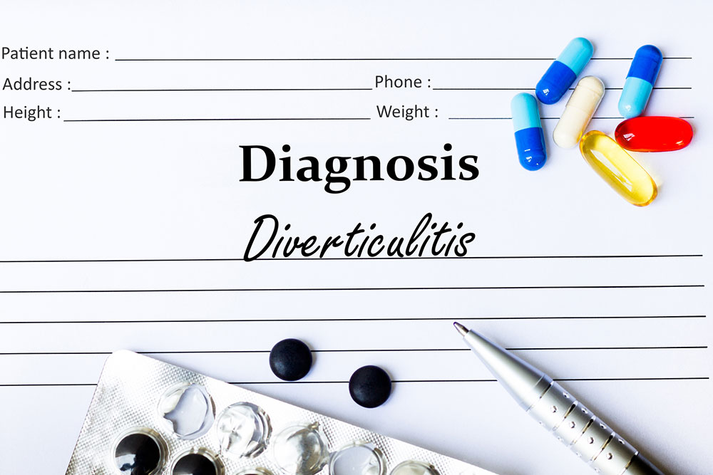 11 Foods that Trigger Diverticulitis