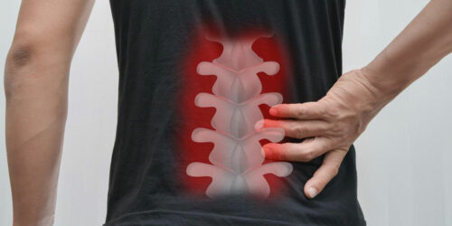 A brief overview of spinal fusion surgery