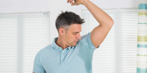 Causes, Complications, and Treatments for Excessive Sweating