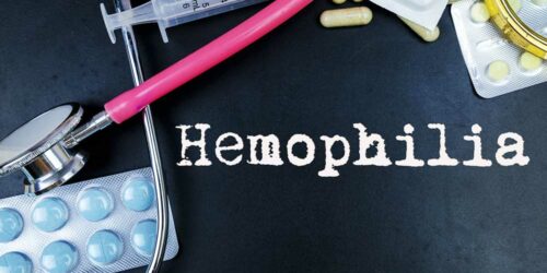 Causes, Symptoms, and Complications of Hemophilia