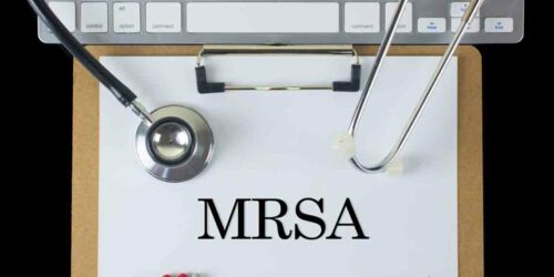 Causes, Symptoms and Treatment for MRSA