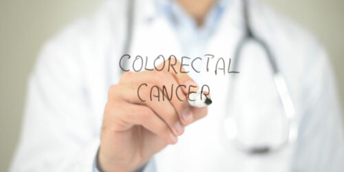 Causes and Diagnosis of Colorectal Cancer