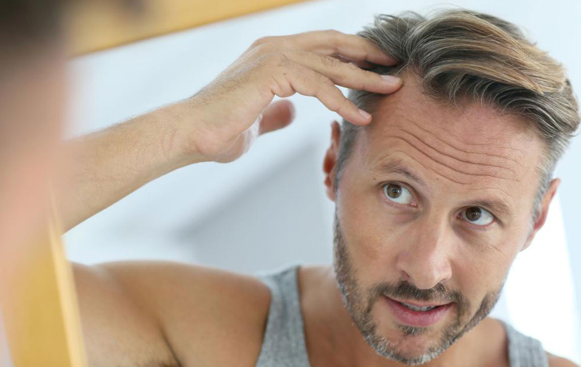 Causes and remedies of hair loss