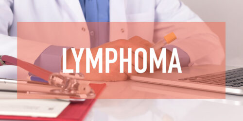 Common Causes, Risk Factors, and Symptoms of Lymphoma