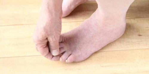 Common Diabetic Feet problems and Its Preventive Measures