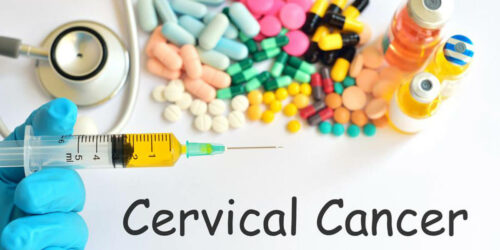 Do You Have Any of These Cervical Cancer Symptoms?