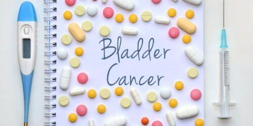 Do You Have Any of These Bladder Cancer Symptoms?