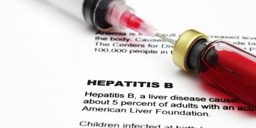 Do You Have These Hepatitis B Symptoms?