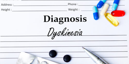 Effect Of Dyskinesia On Parkinson’s Patients