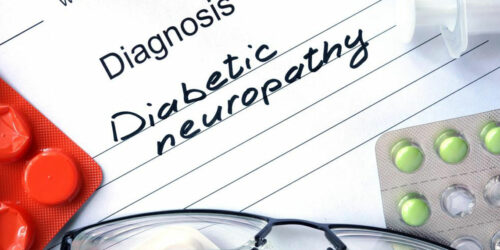 Everything You Need to Know about Diabetic Neuropathy