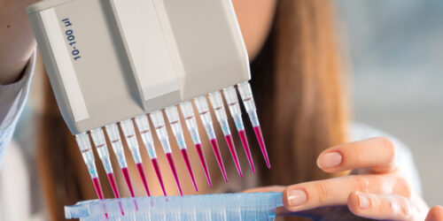 Factors To Consider While Choosing A Dna Testing Kit