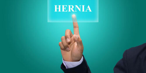 Find the Best Hernia Treatment for You