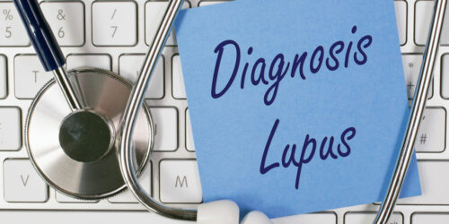 First Symptoms of Lupus to Watch Out For