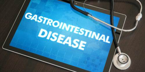 Gastrointestinal stromal tumor &#8211; Risk factors and survival rate