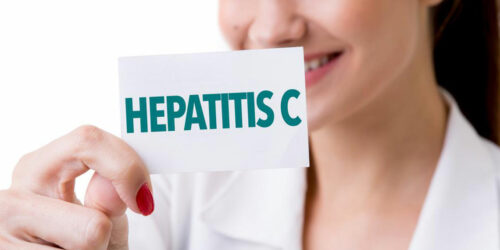 Hepatitis C &#8211; Causes, Symptoms, and Diagnosis