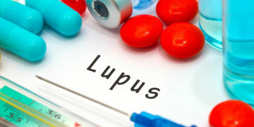 Here Are the 8 Early Signs of Lupus