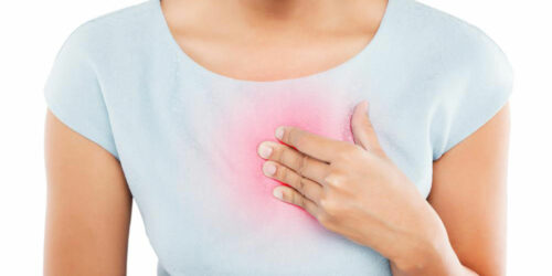 How to Treat and Prevent Heartburn and Indigestion